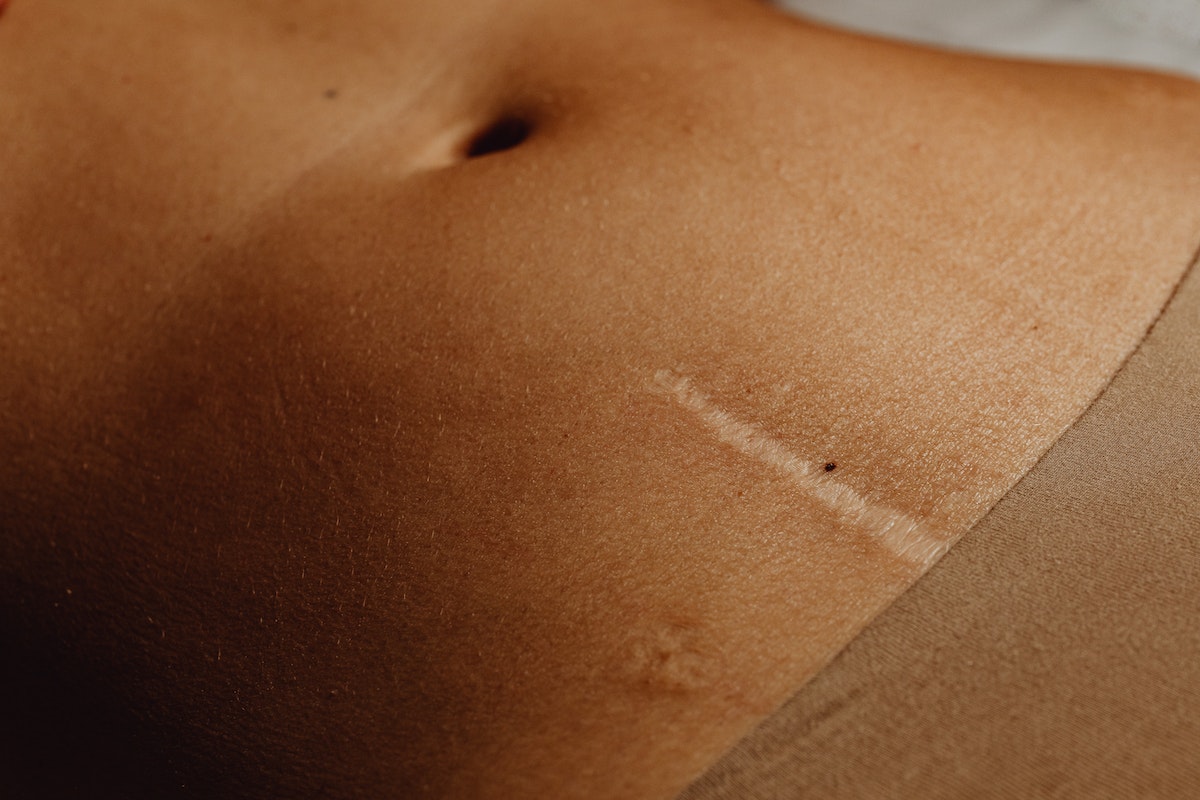 MEDICAL SKIN APPLICATIONS